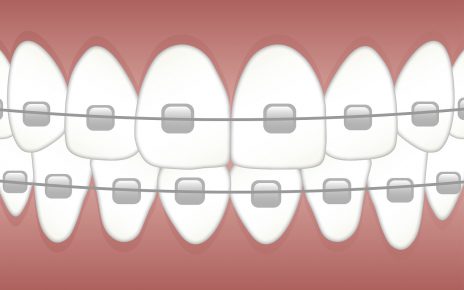 ortodonta, dentysta