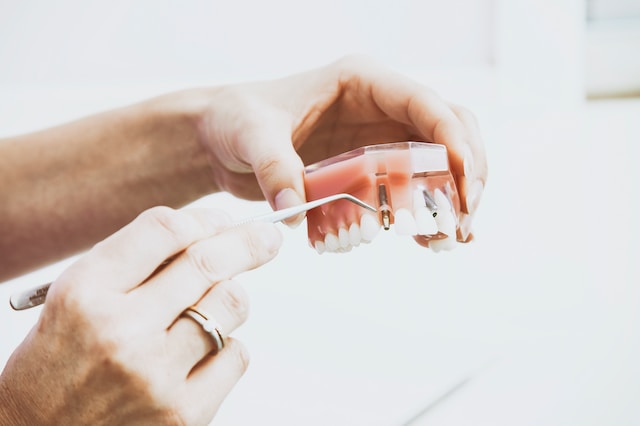 rodzaje protez zębowych
