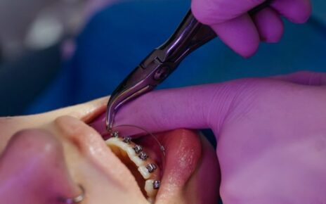 Czy aparat ortodontyczny przeszkadza w mówieniu?