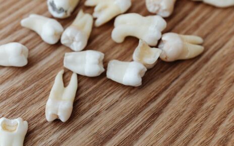 Krwawiące dziąsła – czy to powód do wizyty u periodontologa?