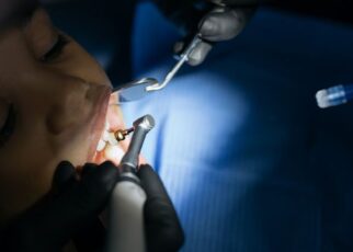 Jak periodontolog leczy odsłonięte szyjki zębowe?
