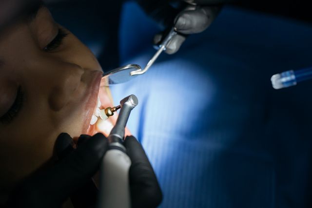Jak periodontolog leczy odsłonięte szyjki zębowe?